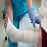 کارشناس زخم دیابتی و زخم بستر در منزل