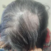 از تغییر نترس