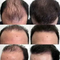 دور کم‌پشتی رو خط بکش