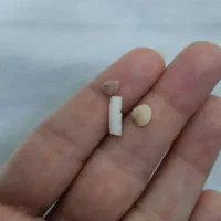 مهره
