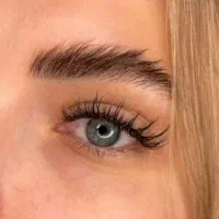 «کاشت مژه هیدن (تخفیف ویژه به مدت محدود)