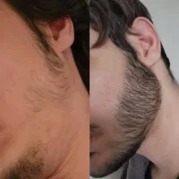 اینیکی فرق داره