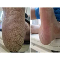 اموزش پدیکور ب روش روسی