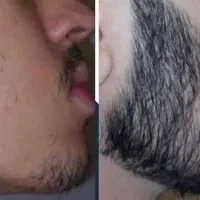 این اقدام آخریشه