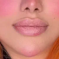 تزریقات زیبایی