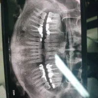 دندانپزشکی شادی فارسان