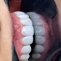 تخفیف ویژه کامپوزیت