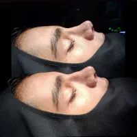 انواع جراحی صورت و بادی با بهترین متخصص های زیبایی