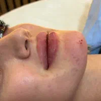 تزریق تخصصی فیلر بوتاکس جوانساز prp مزومو ژل