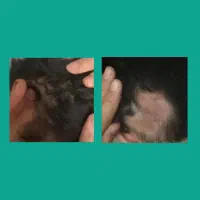 دیگه سکه ای نمیریزه اگه ریشه ای درمانش کنی