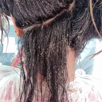 پاکسازی تک جلسه ای شپش ورشک سر در مکانی خصوصی