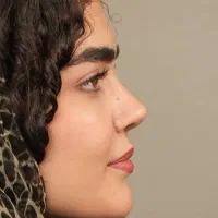 بازسازی و اصلاح هارمونی صورت (طرح ویژه)