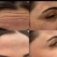 کرم بیوممتیک معجزه بخش
