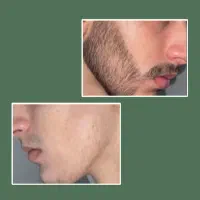 رازِ داشتن ریشِ مرتب و پرپشت
