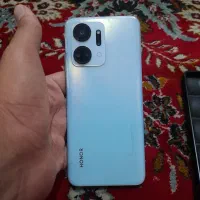 فروش فوری گوشی آنر x7a