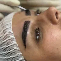 کاشت مو تخصصی و تضمینی