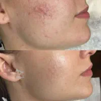 کرم جوانه گندم  اصل ویتابلا