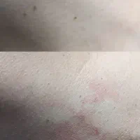 کمترین هزینه و ایمن ترین روش برداشت خال و زیگیل