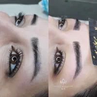 مدل میکروبلیدینگ  زیر نظر استاد