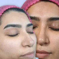 انجام اصلاح خیس و انواع اصلاح