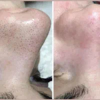 وقت بهاره پوستت رسیده