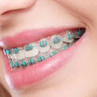 با اعتماد به نفس بخند.ارتودنسی و دندانپزشکی اقساط