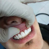 دندان|خدمات آرایشگری و زیبایی|تبریز, |دیوار