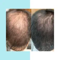 با این روش به موهات حالت بده