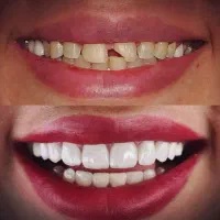 کلیه خدمات دندانپزشکی با اقساط و ۱۶ سال سابقه