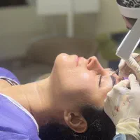 کاشت ابرو طبیعی / کاشت مو / پی ار پی/ مزوتراپی