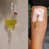خدمات تزریق سرم و پانسمان در منزل