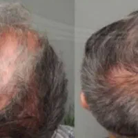 از افسردگی نجاتت میده