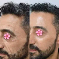 جوانسازی طبیعی