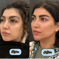 جشنواره تخفیفات کلینیک زیبایی ژل و بوتاکس