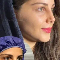 عمل جراحی بینی لیفت خدمات زیبایی با متد پیشرفته
