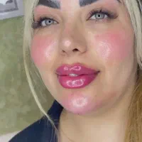 جشنواره تزریق ژل و بوتاکس توسط پزشک
