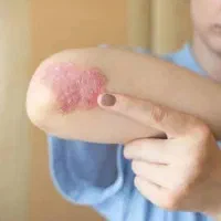 معجزه قرن مخصوص بیماری خود‌ایمنی