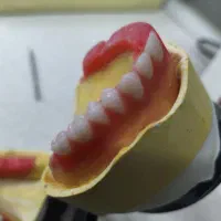 دست دندان کامل با تخفیف و قیمت مناسب
