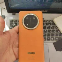 honor x9c|موبایل|تبریز, |دیوار