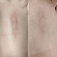 زیبایی پوستت دیگه یه رویا نیست