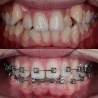 اخرین فرصت ارتودنسی با تعرفه ی سال قبل در شیراز، فرهنگ شهر، بلوار شهید رجایی