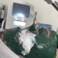 فیشال تخصصی و درمان مشکلات پوستی
