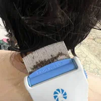 پاکسازی شپش و رشک بایک جلسه تضمینی توس33