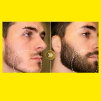 چاره کار ریش کم حجم اینجاست