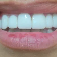 همکاری با دندانپزشک