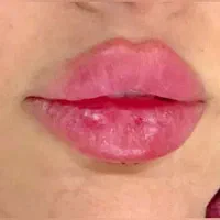 کلینیک زیبایی VIP ژل و بوتاکس تخصصی