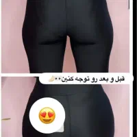 طراحی فیلرباسن.فیلربادی و فیلر سینه توسط پزشک خانم