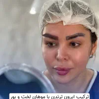 کاشت ابرو تخصصی و همراه با لیفت-شرایط اقساطی