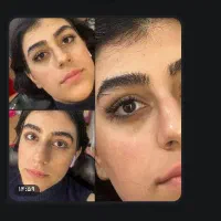 نیازمند مدل کاشت مژه با کمترین هزینه(رایگان)