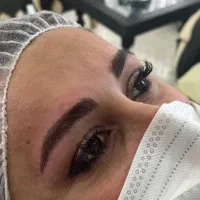 خدمات فیبروز ابرو با تخفیف
